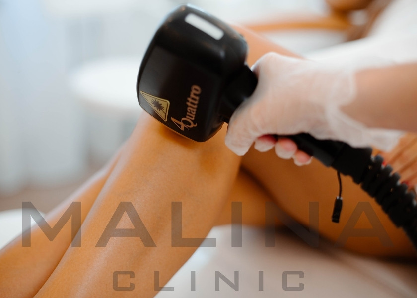 Tratament de epilare din portofoliul Malina Clinic