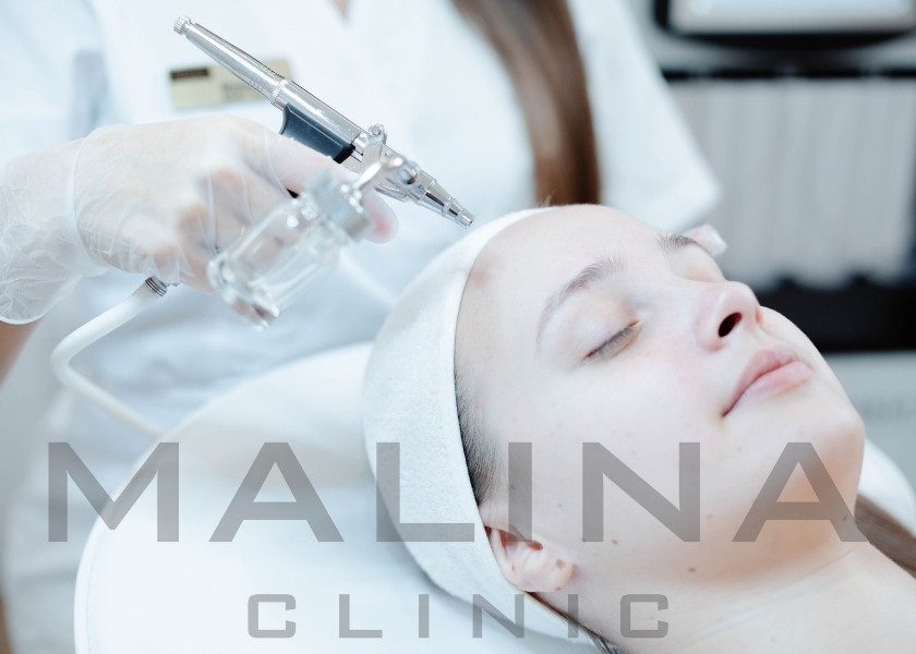 Tratament facial cu oxigen, imagine de pe site-ul Malina Clinic