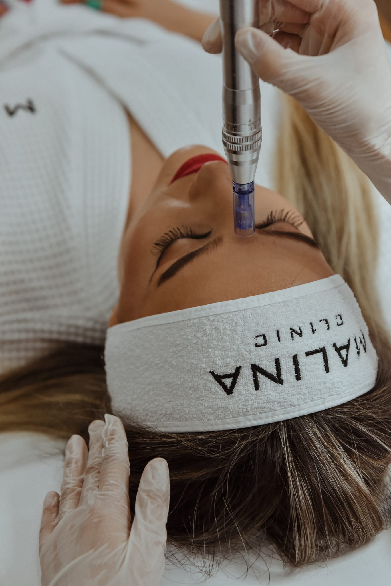Tratament facial cu aplicator pentru microneedling