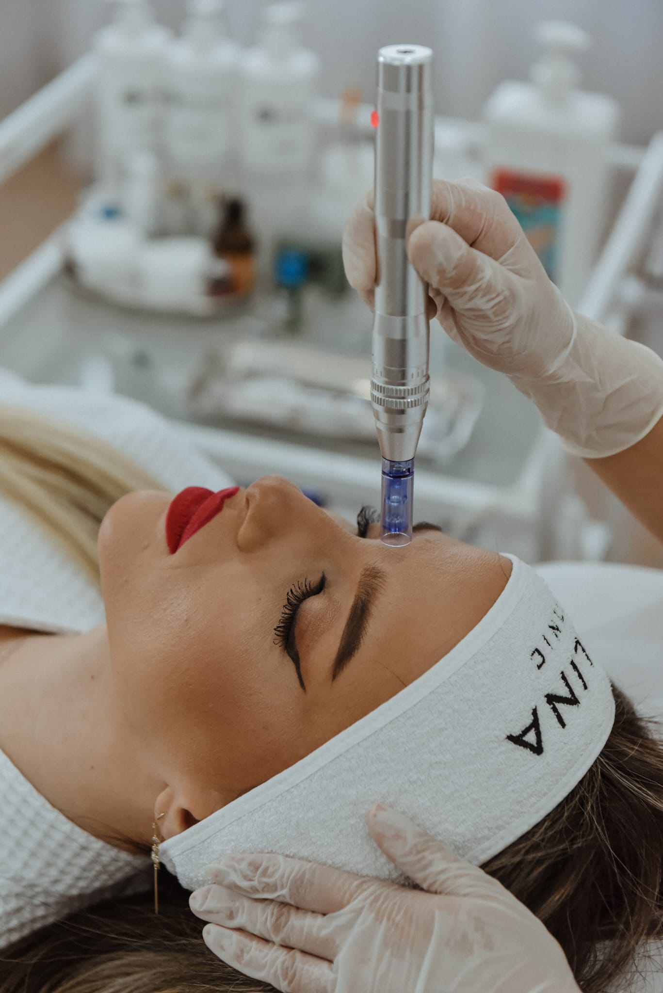 Aplicator pentru microneedling în cadrul unui tratament facial la Malina Clinic
